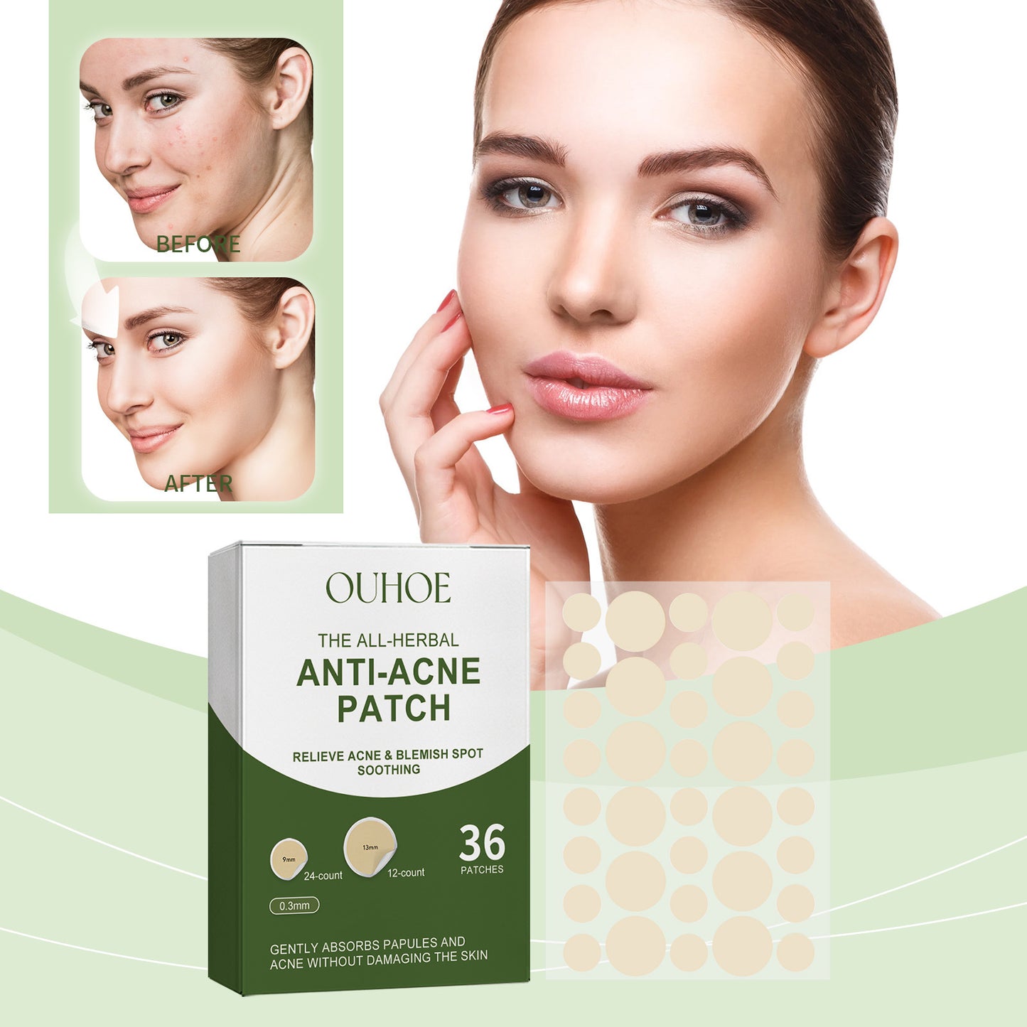 Acne Miracle Patch Removes Pimples Skin Care